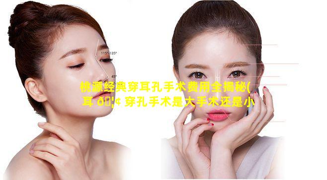 桃源经典穿耳孔手术费用全揭秘(耳 🦢 穿孔手术是大手术还是小手术)